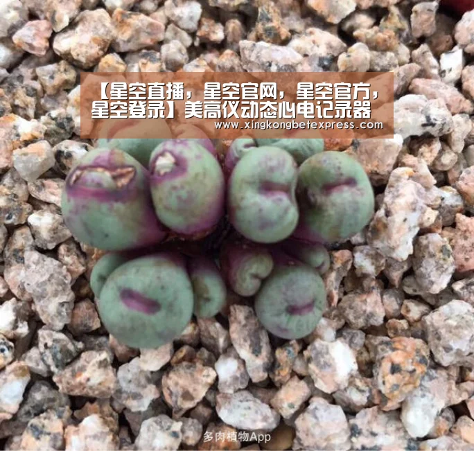 【星空直播,星空官网,星空官方,星空登录】美高仪动态心电记录器全国代理(图1) 星空直播,星空官网,星空官方,星空登录